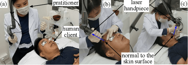 Figure 1 for Robotics Meets Cosmetic Dermatology: Development of a Novel Vision-Guided System for Skin Photo-Rejuvenation