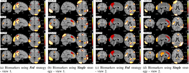 Figure 2 for Multi-site fMRI Analysis Using Privacy-preserving Federated Learning and Domain Adaptation: ABIDE Results