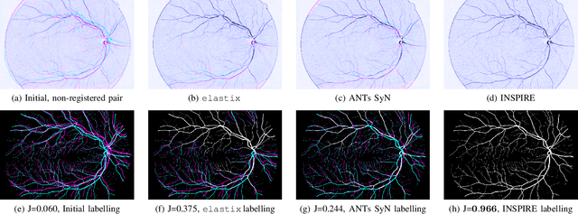 Figure 1 for INSPIRE: Intensity and Spatial Information-Based Deformable Image Registration