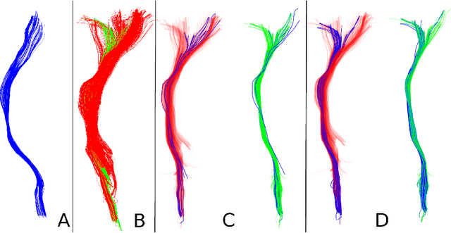 Figure 3 for Mapping Tractography Across Subjects