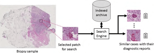 Figure 1 for Yottixel -- An Image Search Engine for Large Archives of Histopathology Whole Slide Images