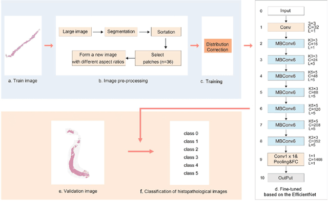 Figure 3 for Automated Prostate Cancer Diagnosis Based on Gleason Grading Using Convolutional Neural Network