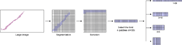 Figure 4 for Automated Prostate Cancer Diagnosis Based on Gleason Grading Using Convolutional Neural Network