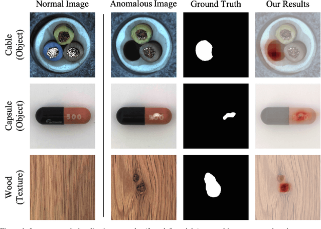 Figure 1 for PEDENet: Image Anomaly Localization via Patch Embedding and Density Estimation