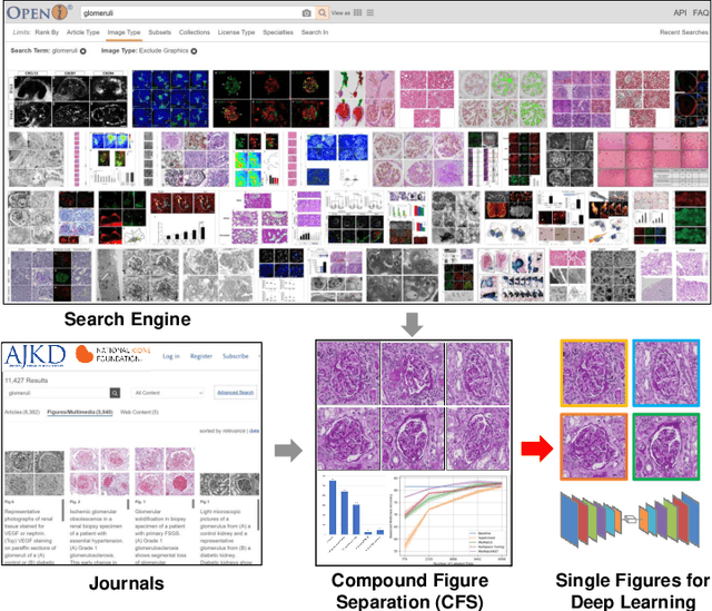 Figure 1 for Compound Figure Separation of Biomedical Images with Side Loss