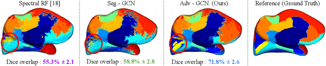 Figure 4 for Graph Domain Adaptation for Alignment-Invariant Brain Surface Segmentation