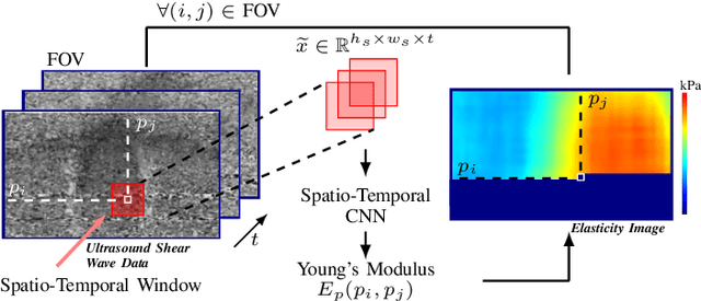 Figure 1 for Ultrasound Shear Wave Elasticity Imaging with Spatio-Temporal Deep Learning
