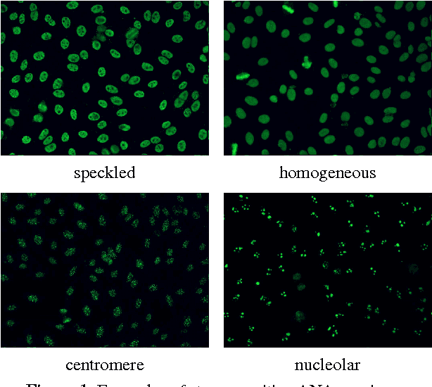 Figure 1 for Classification of Human Epithelial Type 2 Cell Indirect Immunofluoresence Images via Codebook Based Descriptors