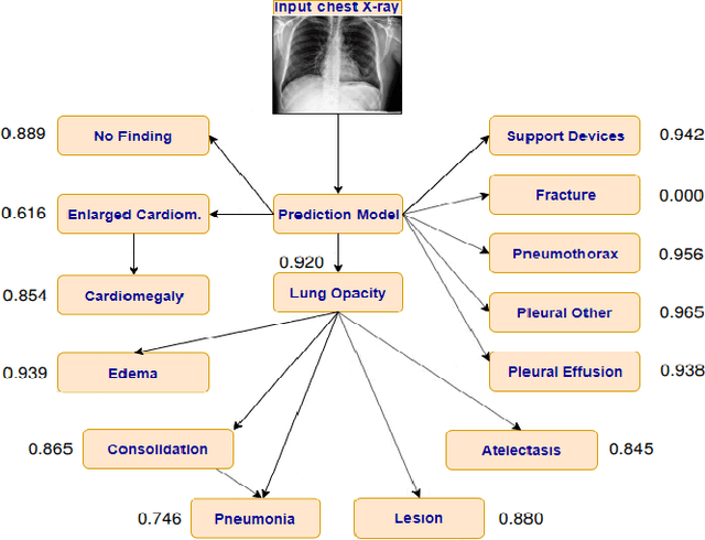 Figure 1 for Interpreting chest X-rays via CNNs that exploit disease dependencies and uncertainty labels