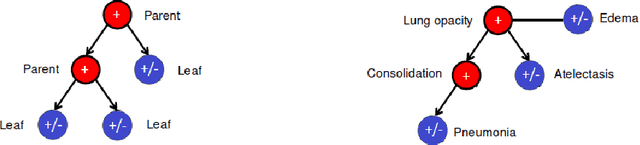 Figure 3 for Interpreting chest X-rays via CNNs that exploit disease dependencies and uncertainty labels
