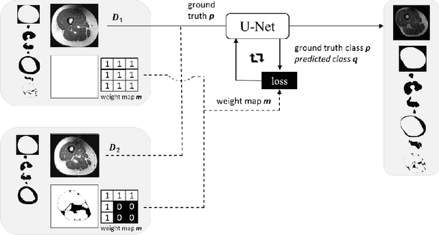 Figure 1 for Combining Heterogeneously Labeled Datasets For Training Segmentation Networks