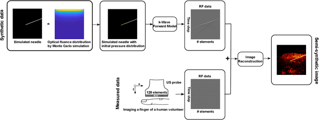 Figure 1 for Improving needle visibility in LED-based photoacoustic imaging using deep learning with semi-synthetic datasets