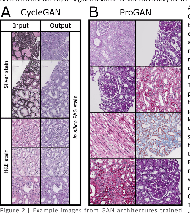 Figure 2 for Histo-fetch -- On-the-fly processing of gigapixel whole slide images simplifies and speeds neural network training