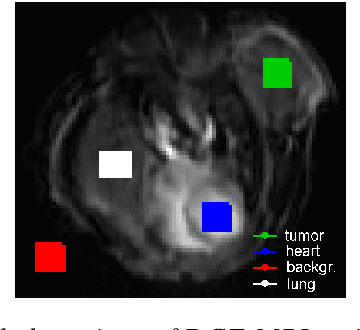 Figure 3 for Multivariate mathematical morphology for DCE-MRI image analysis in angiogenesis studies