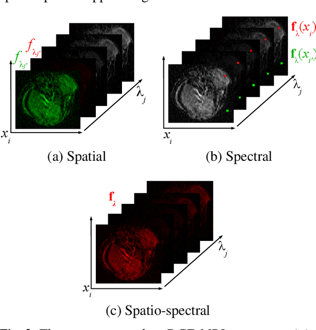 Figure 4 for Multivariate mathematical morphology for DCE-MRI image analysis in angiogenesis studies