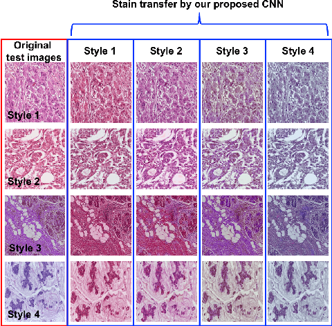 Figure 1 for Neural Stain Normalization and Unsupervised Classification of Cell Nuclei in Histopathological Breast Cancer Images