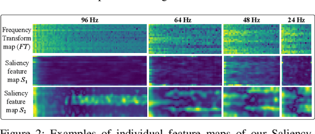 Figure 3 for SeizureNet: A Deep Convolutional Neural Network for Accurate Seizure Type Classification and Seizure Detection