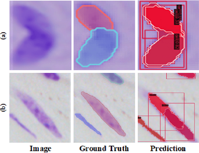 Figure 1 for Look in Different Views: Multi-Scheme Regression Guided Cell Instance Segmentation