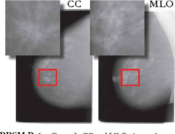 Figure 1 for Optimizing and Visualizing Deep Learning for Benign/Malignant Classification in Breast Tumors