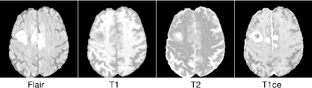 Figure 1 for Belief function-based semi-supervised learning for brain tumor segmentation