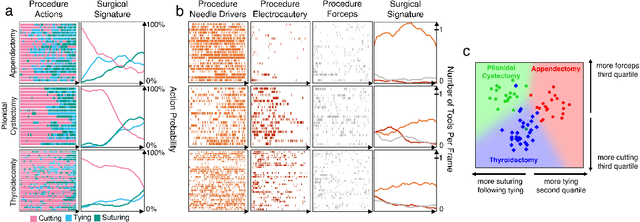 Figure 3 for A real-time spatiotemporal AI model analyzes skill in open surgical videos