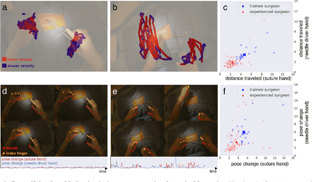 Figure 4 for A real-time spatiotemporal AI model analyzes skill in open surgical videos