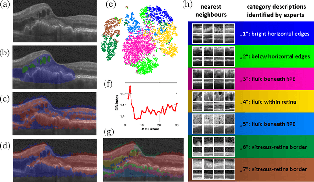 Figure 2 for Identifying and Categorizing Anomalies in Retinal Imaging Data