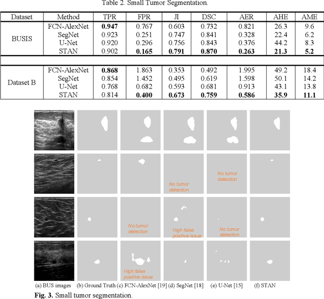 Figure 4 for Stan: Small tumor-aware network for breast ultrasound image segmentation