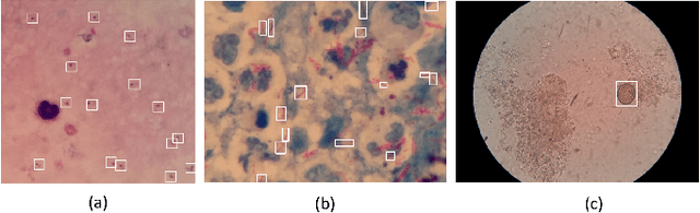 Figure 1 for Low-Power Hardware-Based Deep-Learning Diagnostics Support Case Study