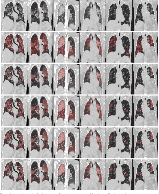Figure 4 for Dense Regression Activation Maps For Lesion Segmentation in CT scans of COVID-19 patients
