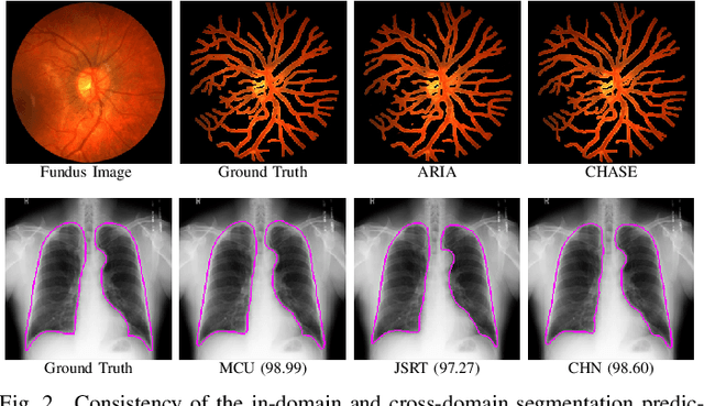 Figure 2 for Progressive Adversarial Semantic Segmentation