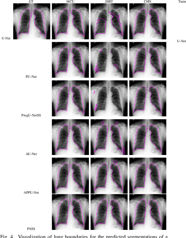 Figure 4 for Progressive Adversarial Semantic Segmentation