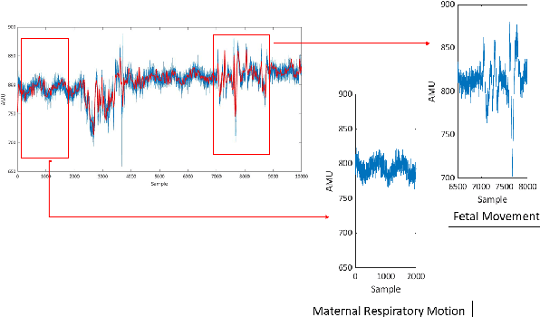 Figure 2 for Assessment of Fetal and Maternal Well-Being During Pregnancy Using Passive Wearable Inertial Sensor