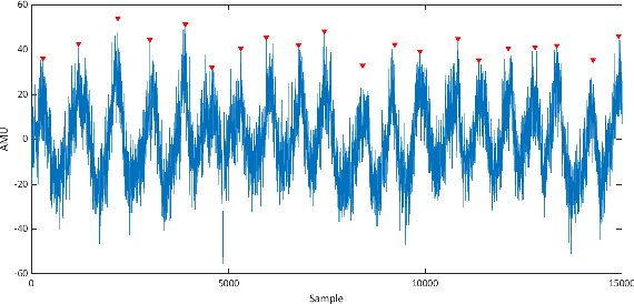 Figure 4 for Assessment of Fetal and Maternal Well-Being During Pregnancy Using Passive Wearable Inertial Sensor