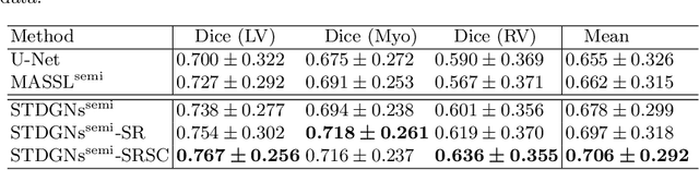 Figure 4 for Random Style Transfer based Domain Generalization Networks Integrating Shape and Spatial Information