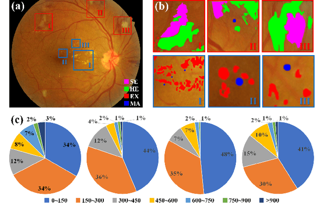 Figure 1 for RTNet: Relation Transformer Network for Diabetic Retinopathy Multi-lesion Segmentation