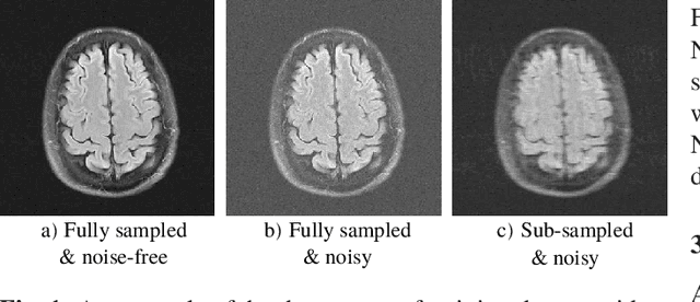 Figure 2 for Simultaneous self-supervised reconstruction and denoising of sub-sampled MRI data with Noisier2Noise