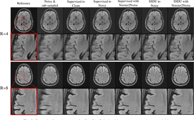 Figure 3 for Simultaneous self-supervised reconstruction and denoising of sub-sampled MRI data with Noisier2Noise