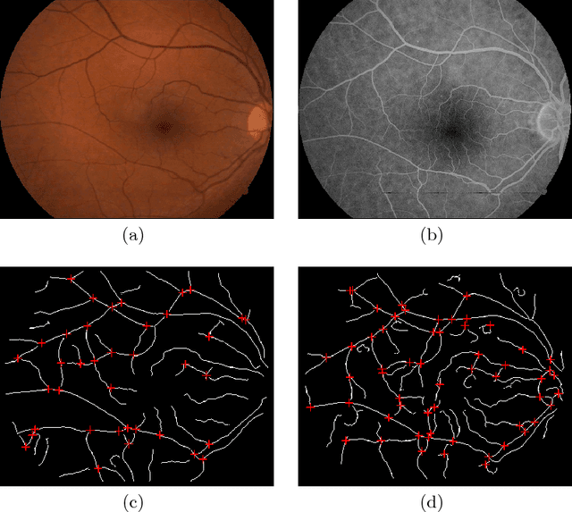 Figure 1 for Multimodal Registration of Retinal Images Using Domain-Specific Landmarks and Vessel Enhancement