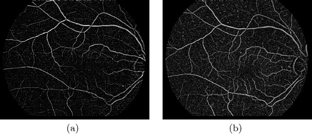 Figure 3 for Multimodal Registration of Retinal Images Using Domain-Specific Landmarks and Vessel Enhancement