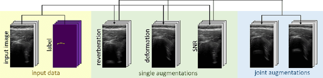 Figure 1 for Rethinking Ultrasound Augmentation: A Physics-Inspired Approach
