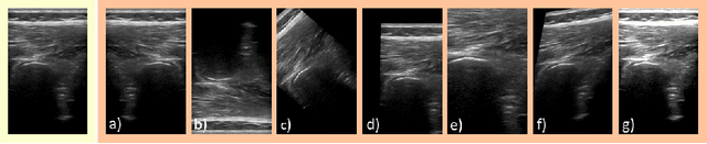 Figure 3 for Rethinking Ultrasound Augmentation: A Physics-Inspired Approach