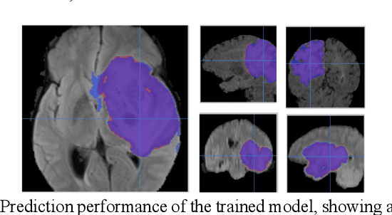 Figure 3 for Addressing the Memory Bottleneck in AI Model Training