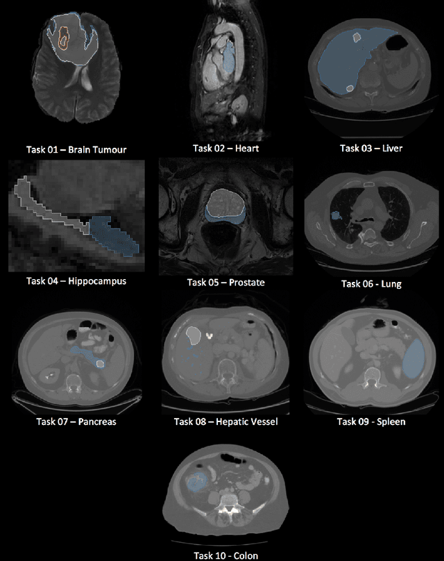 Figure 1 for A large annotated medical image dataset for the development and evaluation of segmentation algorithms