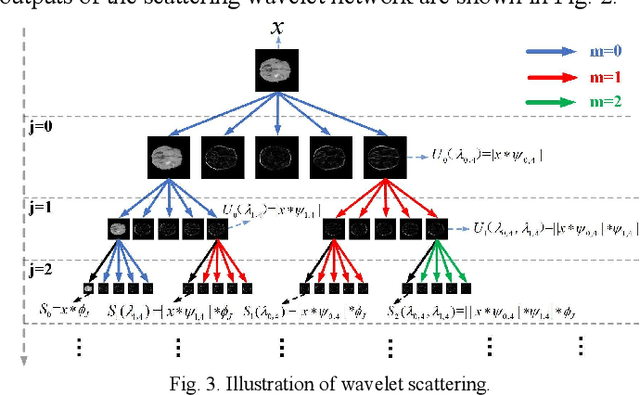 Figure 3 for Glioma Grade Predictions using Scattering Wavelet Transform-Based Radiomics