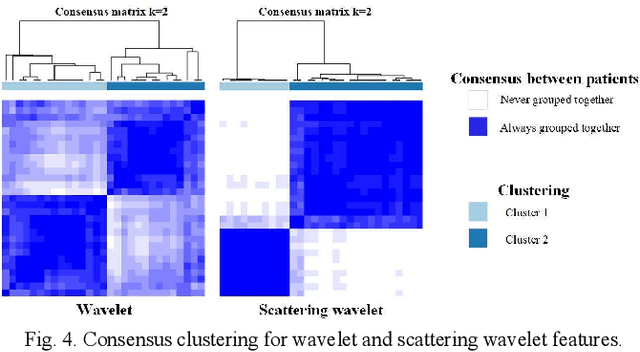 Figure 4 for Glioma Grade Predictions using Scattering Wavelet Transform-Based Radiomics