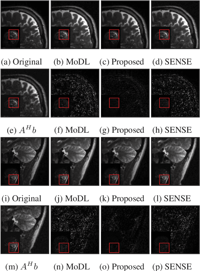 Figure 3 for Off-the-grid model based deep learning (O-MODL)