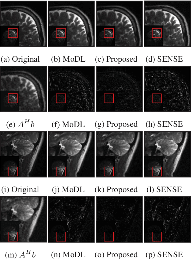 Figure 4 for Off-the-grid model based deep learning (O-MODL)