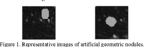 Figure 1 for Deep Learning for the Classification of Lung Nodules