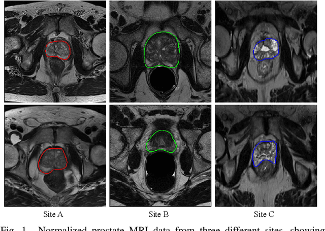 Figure 1 for MS-Net: Multi-Site Network for Improving Prostate Segmentation with Heterogeneous MRI Data